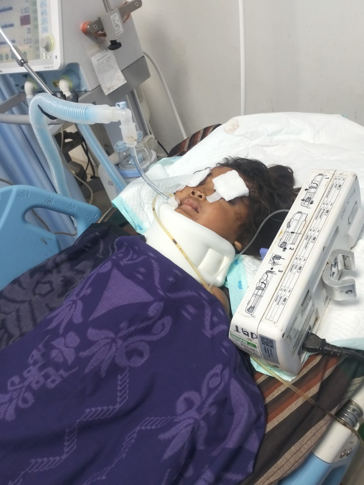 Alya Anak Umur 7 Tahun Pasien gawat darurat asal brongkolon Sumbawa Besar ditolak RSUP Mataram, Ada Apa ?